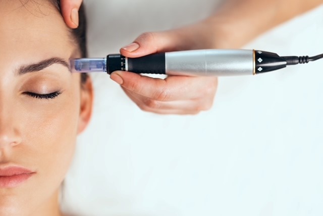 Microneedling im Kosmetikstudio in Frankfurt für verjüngte Haut